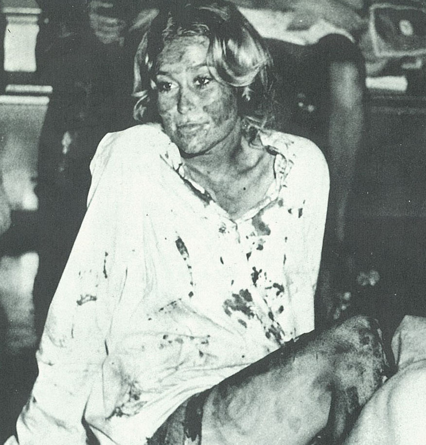 Simulating a burn victim, Gail Day patiently awaits medical care (Seniors posed as disaster victims)